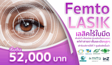Femto LASIK เลสิคไร้ใบมีด