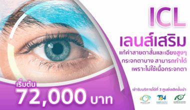 ICL เลนส์เสริมแก้สายตาสั้นและเอียงสูง