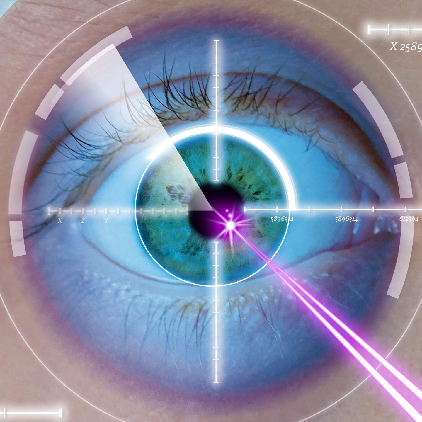 FemtoLASIK คืออะไร